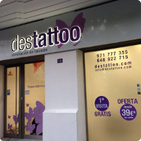 Tattoo removal center in Palma de Mallorca